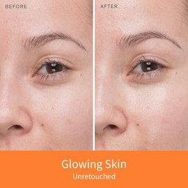 Sulwhasoo Sulwhasoo Concentrated Ginseng Renewing Serum Mini: Hydrates, Visibly Firm, Smooth, and Improves Look of Firmness & Elasticity, 0.50 fl. oz.