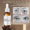 Caffeine Solution 5% + EGCG, Caffeine Eye Serum, Caffeine Eye
