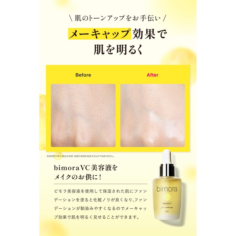 BimoRa Vitamin C Derivative Serum, High Concentration, Rough Skin Care,