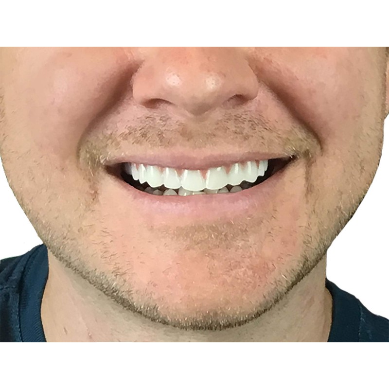 Instant Smile Comfort Fit Flex Natural Shade