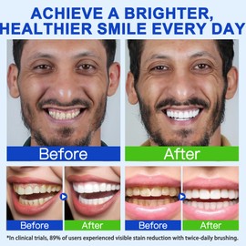 Hydroxyapatite Toothpaste Travel Size for Oral Health Management Fresh Breath, Whitening Mint Toothpaste, Remove Dental Plaque, Repair Damaged Enamel, Improve Enamel's Resistance to Dental Plaque