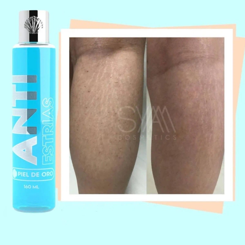 Aceite Hidratante Corporal Antiestrías Piel De Oro By Syam