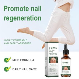 Fungi Nail Liquid 30ml - Onychomycosis Nail Care | Helps Improve Discolored, Cracked & Thickened Toenails & Fingernails | Supports Healthy Nail Renewal
