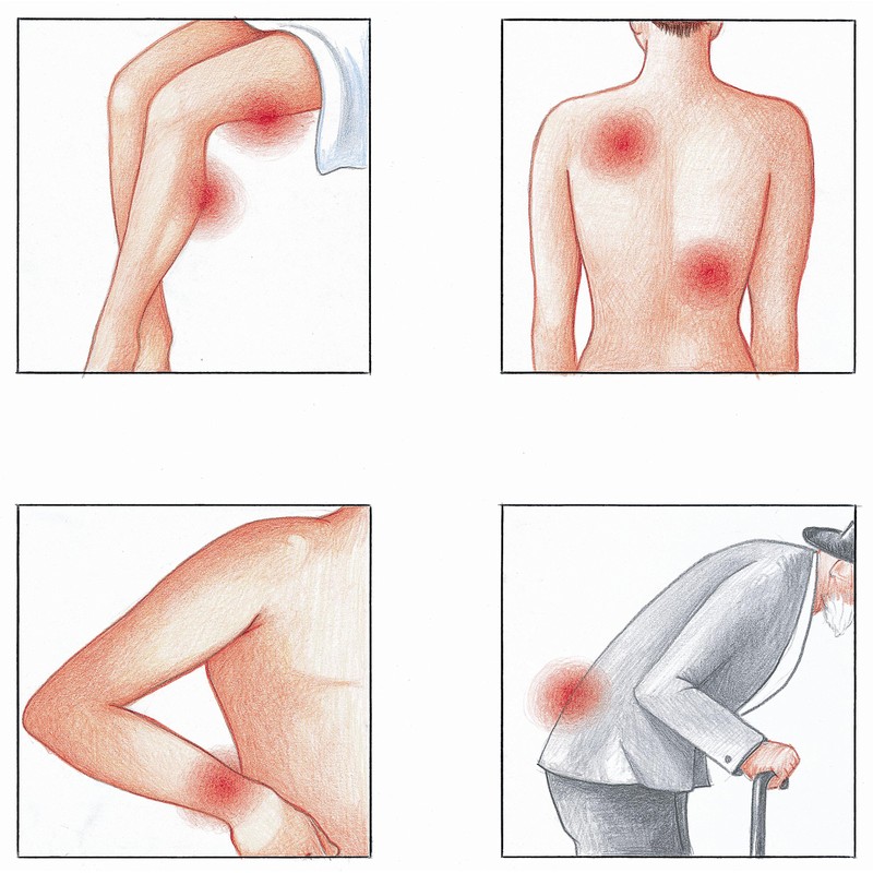 Medosan MedoFlex Gel 150 ml in Pressure Dispenser