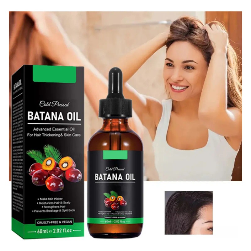 Aceite De Batana For El Crecimiento Del Cabello Con