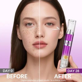 Suero Reparador De Manchas De La Edad Y Pecas