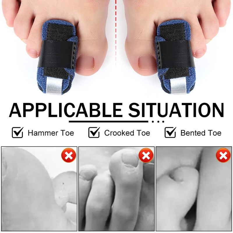 2 Pack Toe Splint Toe Protector, Toe Straightener for Hammer