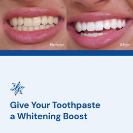 Snow Magic Teeth Whitening Powder with Hydroxyapatite – Tooth Polisher for Sensitive Teeth, Toothpaste Booster for Teeth Cleaning & Color Correction - Lavender & Mint Flavor, 35g
