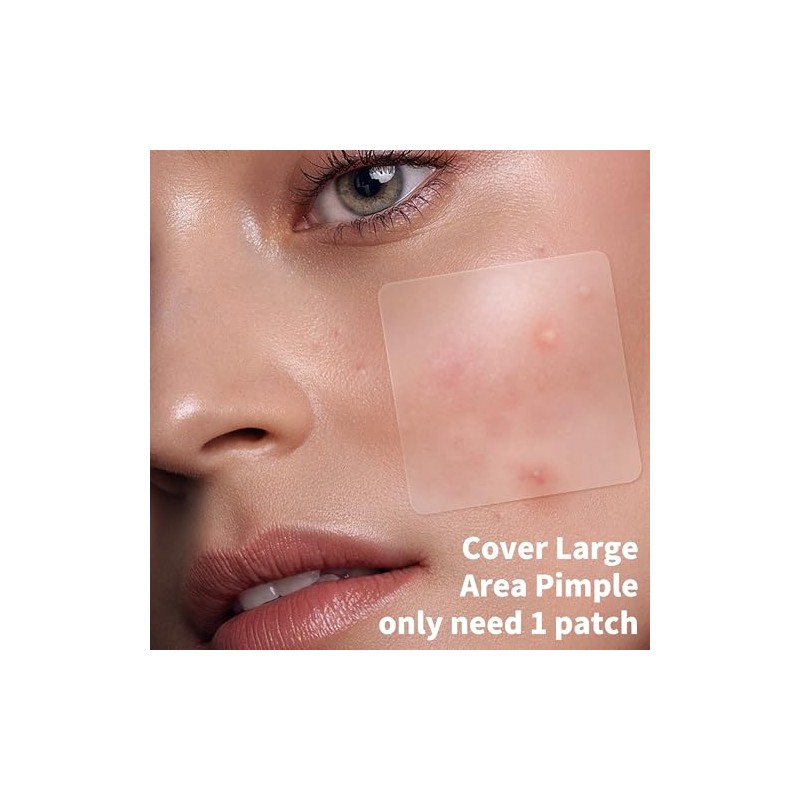 Daolyo Large Hydrocolloid Pimple Patches - 210 Count
