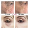 Vitayes Instant Ageback Crema Levantamiento Facial Todo Tipo Piel Día