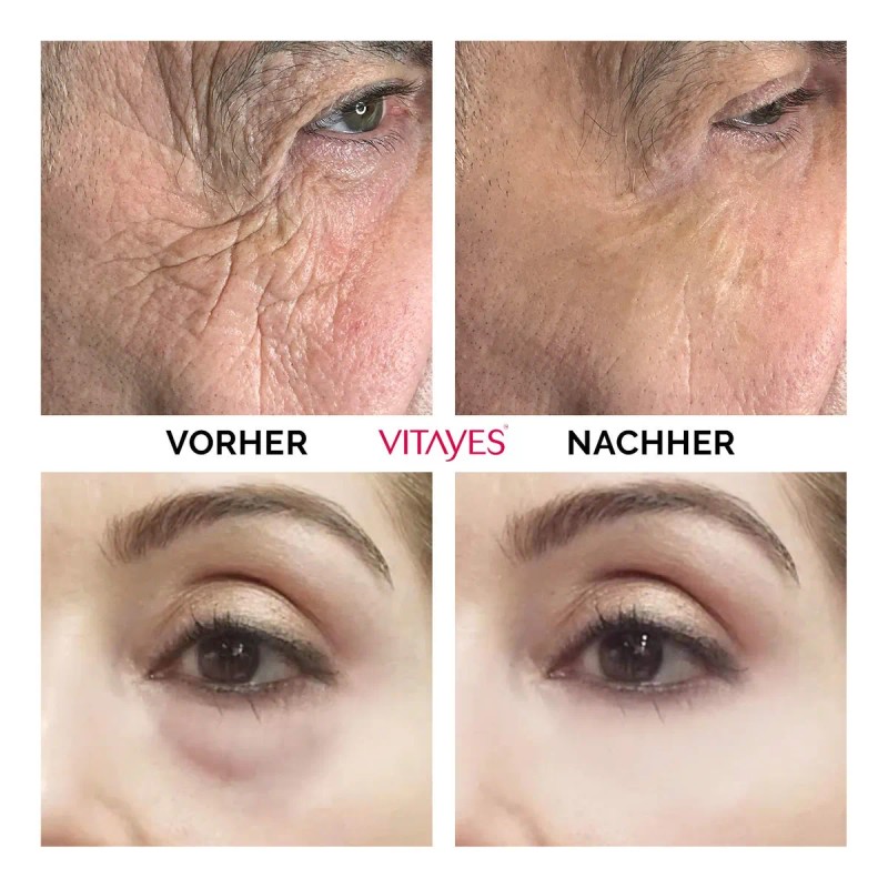 Vitayes Instant Ageback Crema Levantamiento Facial Todo Tipo Piel Día
