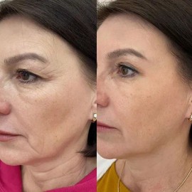 Skincare Antiedad Mary Kay Crema Facial Piel Mixta                                                                                                    
