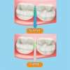 GRIN, Softstx, Hilos Interdentales Suaves y Ecológicos, para una Limpieza