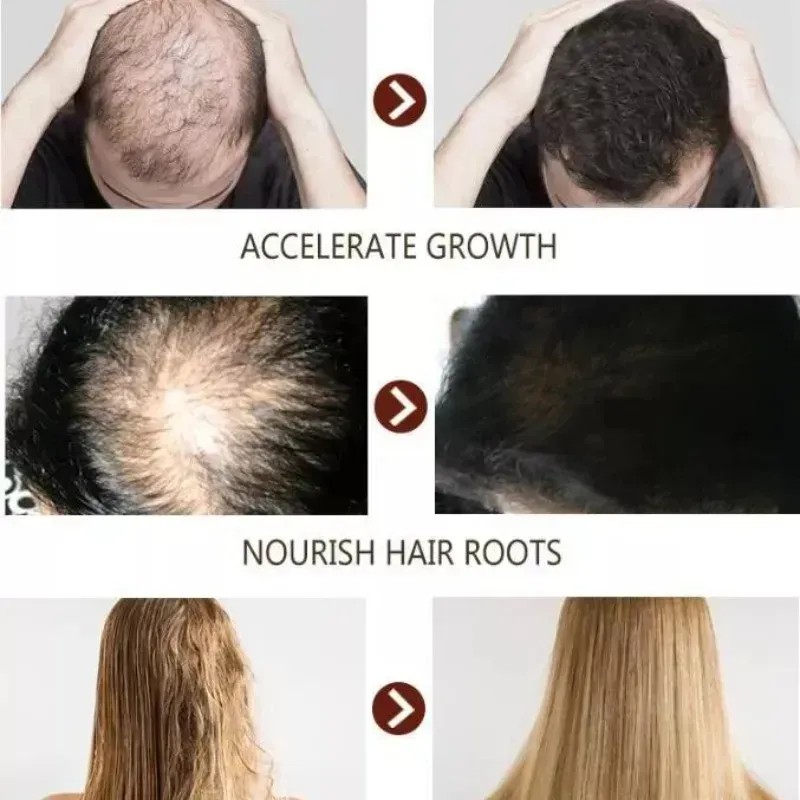 El Sérum Para El Crecimiento Del Cabello Promueve El Crecimi