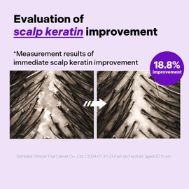 ALIVELAB O2 Scalp Water Shampoo for Sensitive Scalp, Itchy, Anti Dandruff, Deep Cleansing and Soothing, Hair Care, Scalp cleanser, Water Type, Liquid shampoo, Silicone-Free 11.38 fl oz