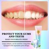 Acssart Radiant Whitening Toothpaste, Niacinamide Whitening Toothpaste, Niacinamide Dazzling Toothpastes