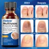 Kit 2 Uñas Hongo Líquido-inhibición 99% Hongos 30ml*2