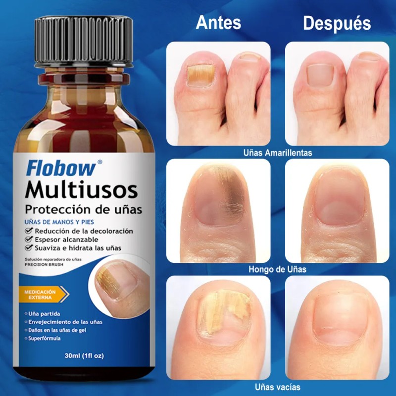 Kit 2 Uñas Hongo Líquido-inhibición 99% Hongos 30ml*2