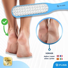 Mr. Fuss® Laser callus rasp - callus removal with callus file - stable non-slip - double-sided, coarse and fine - plastic stainless steel blue