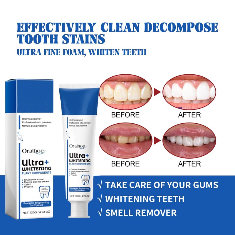 Sp-6 Toothpaste, 120 G Probiotics Bright White Toothpaste Toothpaste Sp-6