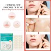 Universo en Linea 72 Parches Invisibles Cubre Acne Espinillas Granos