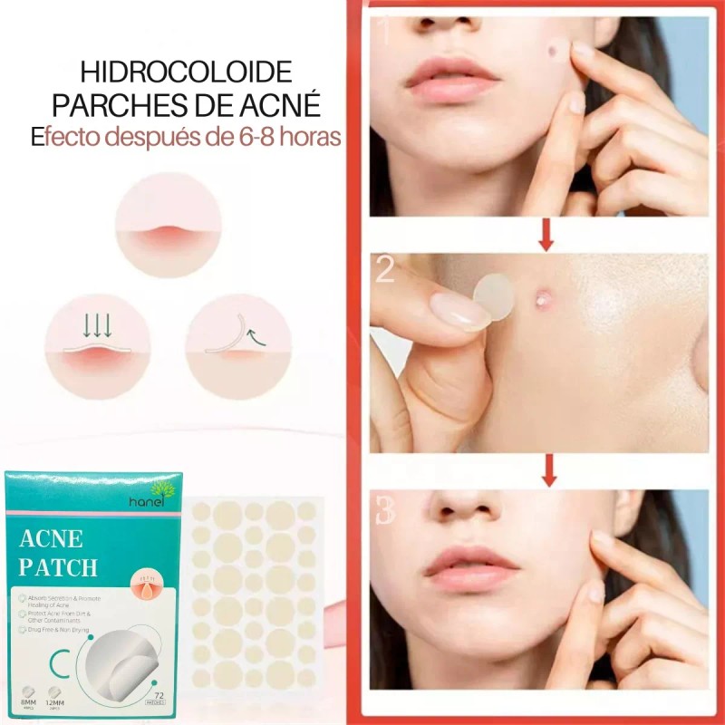 Universo en Linea 72 Parches Invisibles Cubre Acne Espinillas Granos