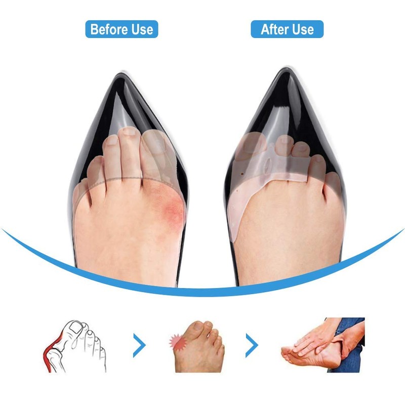 DOACT 3-Hole Bunion Corrector Protector with 5-Hole Big Toe Straighteners,