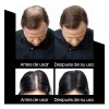 Sevich 50g Fibra Capilar Calvici Barba Cabello Gratis