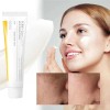 ****** Crema En Gel Hidratante Calmante Para Manchas Oscuras