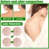 Microdarts Tag'gone Nano Patch,Natural Skin and Face Care Patch，2pc