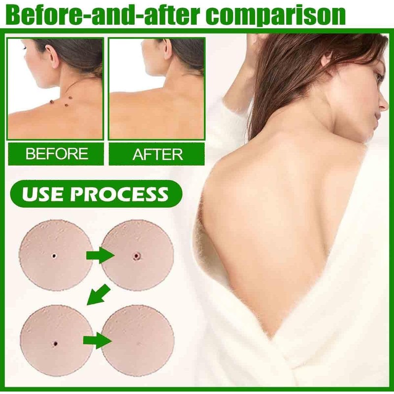 Microdarts Tag'gone Nano Patch,Natural Skin and Face Care Patch，2pc