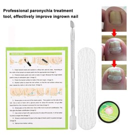 Professional Toenail Correction Paronychia Nail Sticker Correction Ingrown Pincer Toenail Correction Sticker Pedicure Paronychia Recover Foot CareTool (12 Pieces Patches)