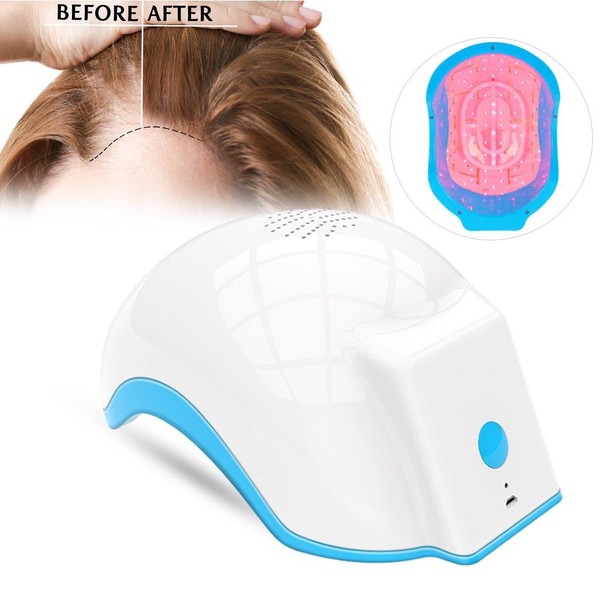 Crazy Sale Hair Growth Helmet, CE Approved Device for Hair Loss (EU)