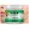 Karakol kream mancha oscura cara cuidado de la piel crema