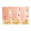Serum Turmeric Glow 50 G, Hidratante Reparador De Alto Brill