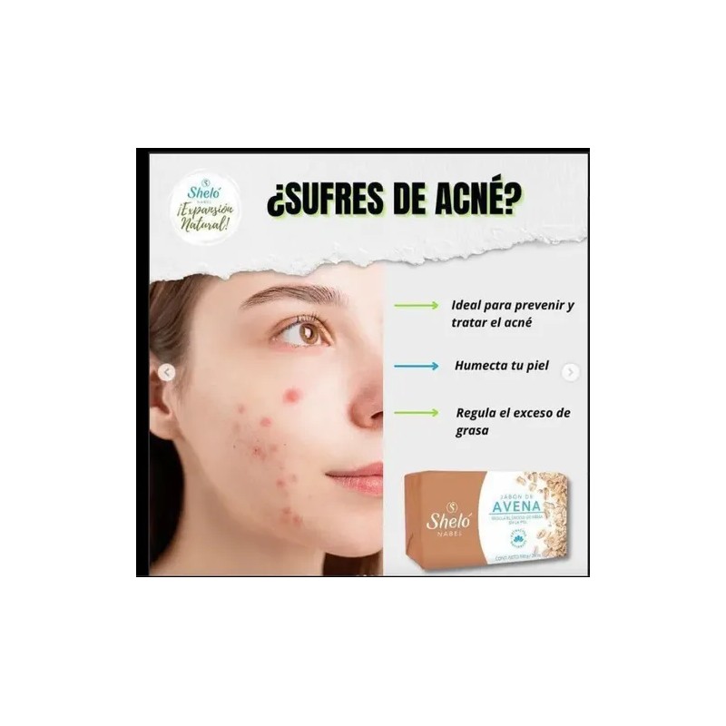 5 Pack Jabón Avena Sheló Nabel Irritación Exceso De Grasa