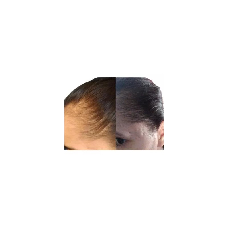 Nutrekcln Crema Acondicionadora Con Nutrientes Para Mejora De Vello