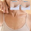 UPIQNG Chest Pad Anti Wrinkle Chest Patche Silicone Reusable Self-Adhesive