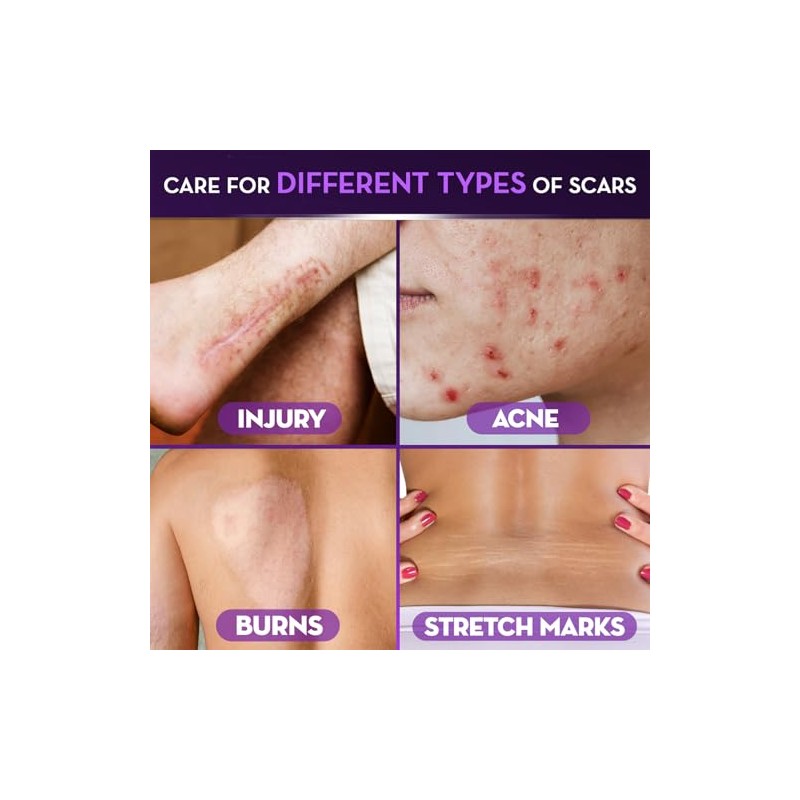 Cicatricure Scar Gel 1.0 oz