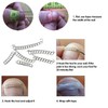 Suweiyuanshiyi Ingrown Toenail Removal Kit,Ingrown Toenail Corrector Tools Come with