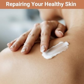 LMNOOP Crema Urticaria para el alivio de la urticaria, tratamiento antipicazón de acción rápida con fórmula herbaria natural para erupciones alérgicas en la piel, enrojecimiento, hinchazón, 3.53 onzas