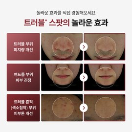 Today With [Today With] Red Control Trouble Spot 15ml, 1 piece / [투데이위드] 레드 컨트롤 트러블 스팟 15ml, 1개