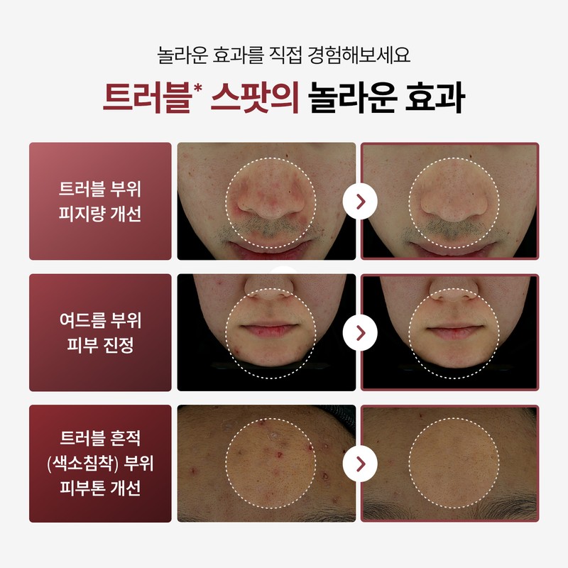 Today With [Today With] Red Control Trouble Spot 15ml, 1