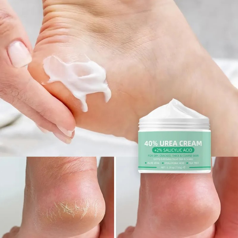 Crema De Urea 40% + 2% Ácido Salicílico Para Pies