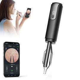 Pinza de eliminación de puntos negros con cámara de 1080p, máxima precisión: pinzas con cámara, perfecta para tareas delicadas. - Pinzas encarnadas para el pelo de las orejas (negro)
