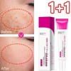 1+1/Blemish/Removal/Pigmentation/Whitening/Cream