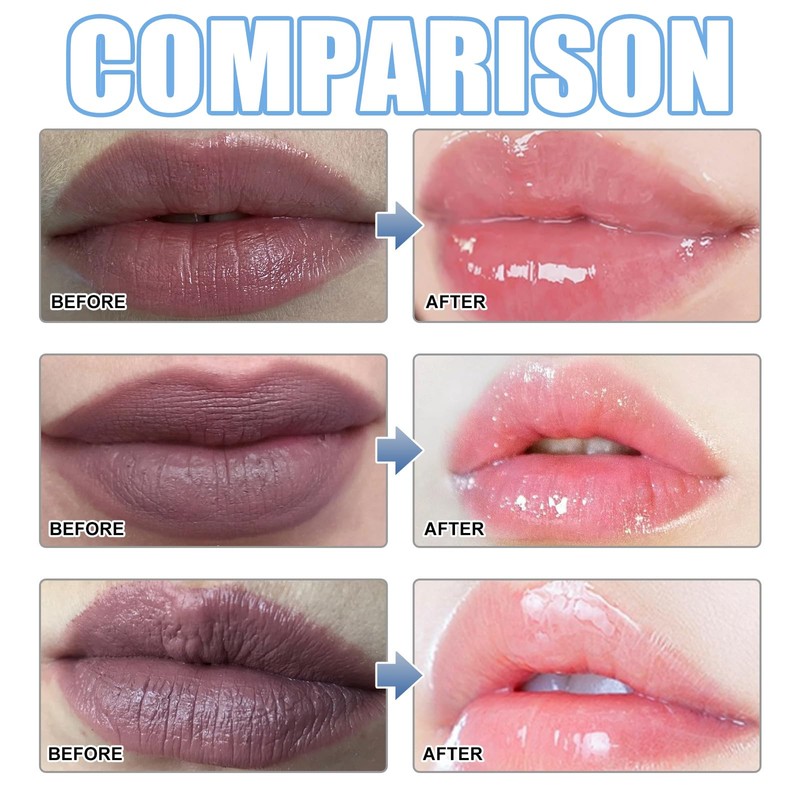 XIRUJNFD Jinshane Lip Serum, Remove Dark Lips Pink Fresh Lightening