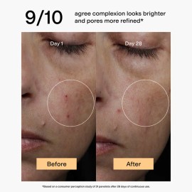 CLEARSTEM BRIGHTMEUP Brightening Toner – 2% BHA & Azelaic Acid Derivative for Acne-Prone, Sensitive Skin | Tone, Clarify & Strengthen – 3.2 fl oz