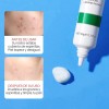 Crema Limpieza Facial Ácido Salicílico