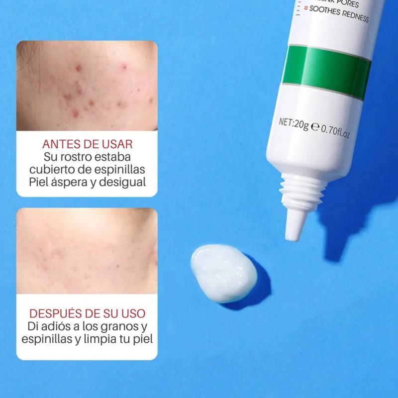 Crema Limpieza Facial Ácido Salicílico